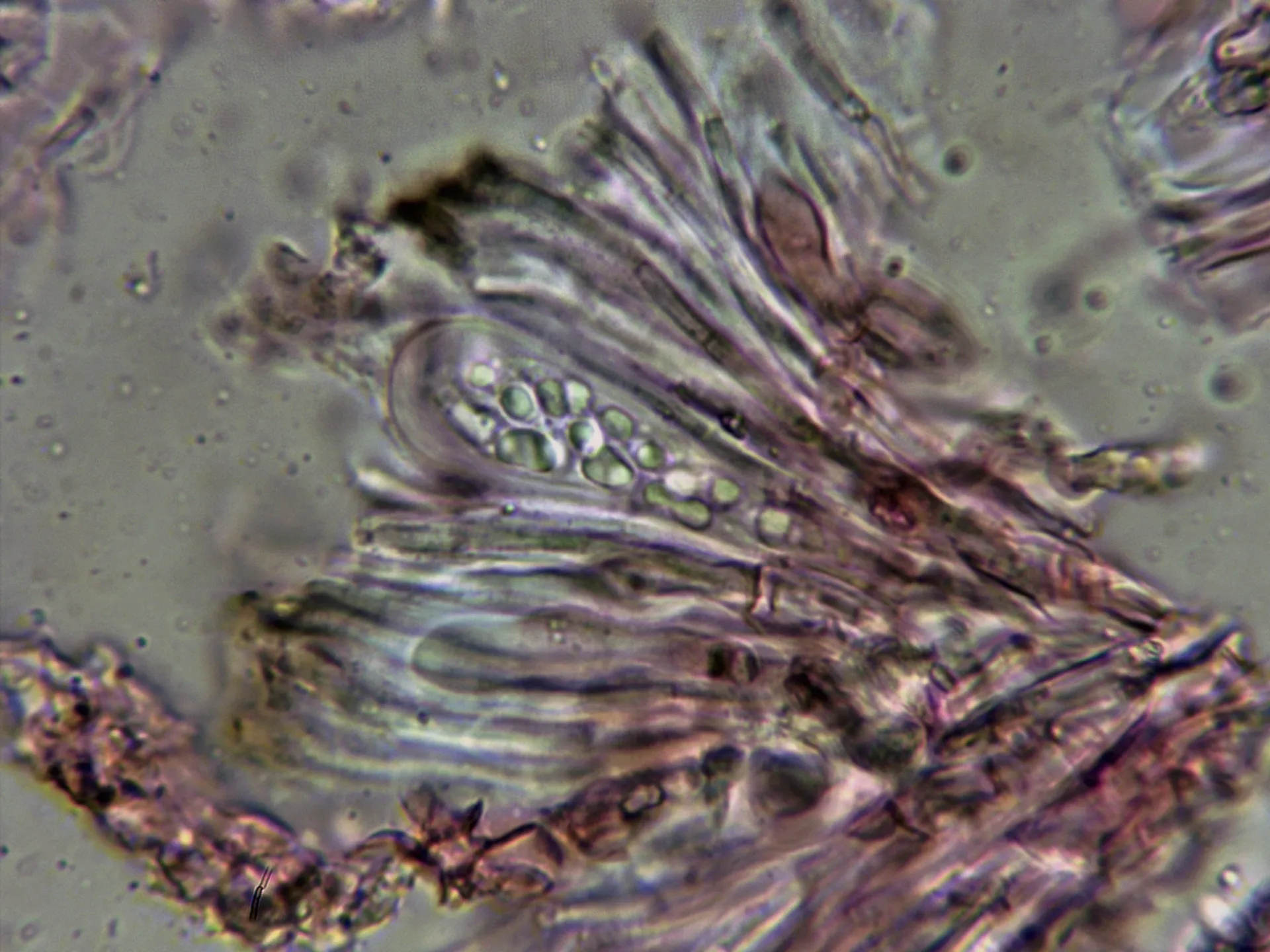 Microscopía de Lecanora horiza - 10 - Asca 3
